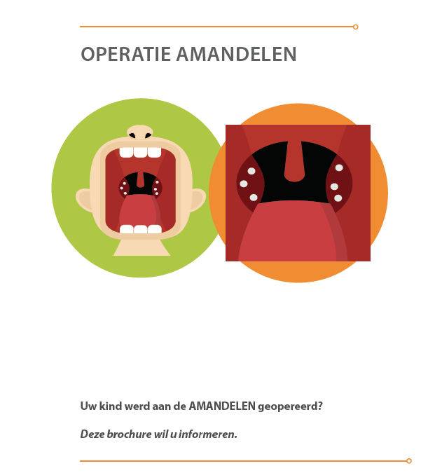 Opération Amygdales