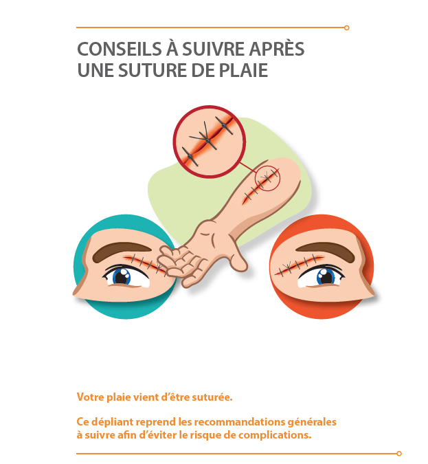 Conseils à suivre après une suture de plaie