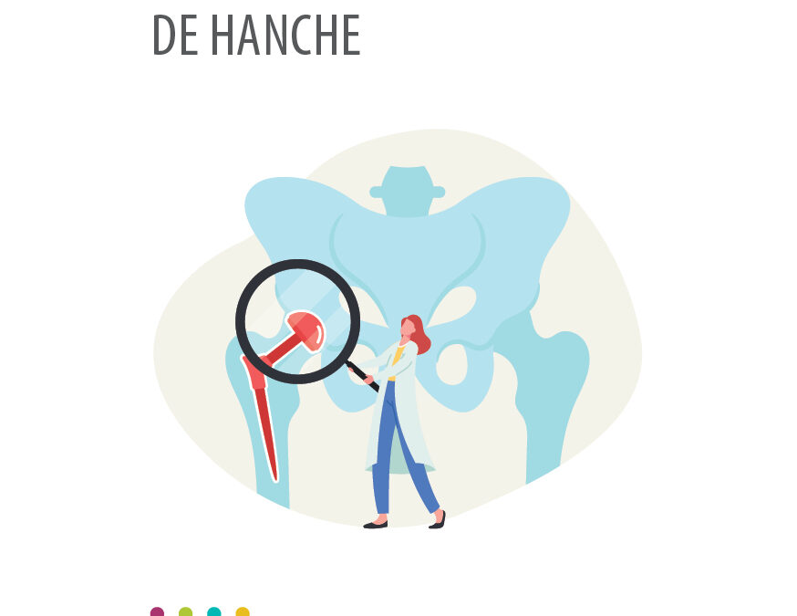 Prothèse totale de hanche