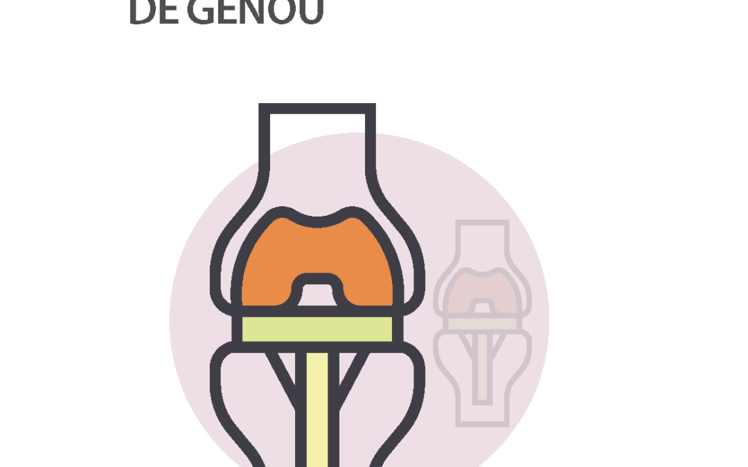 Prothèse totale de genou