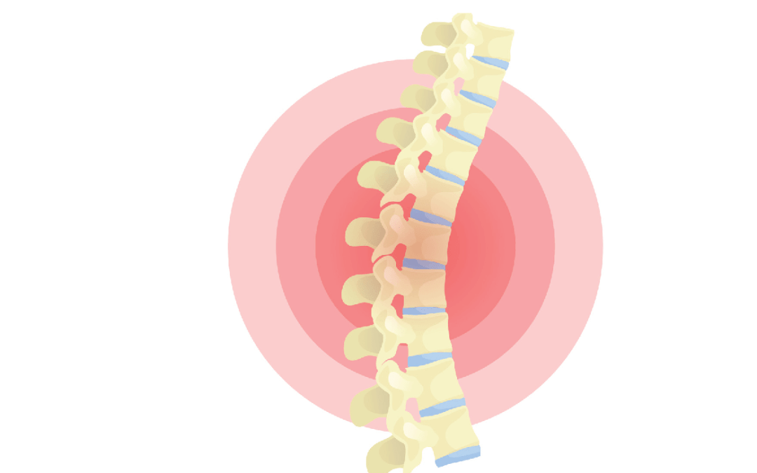Ecole du dos – Protéger son dos au quotidien