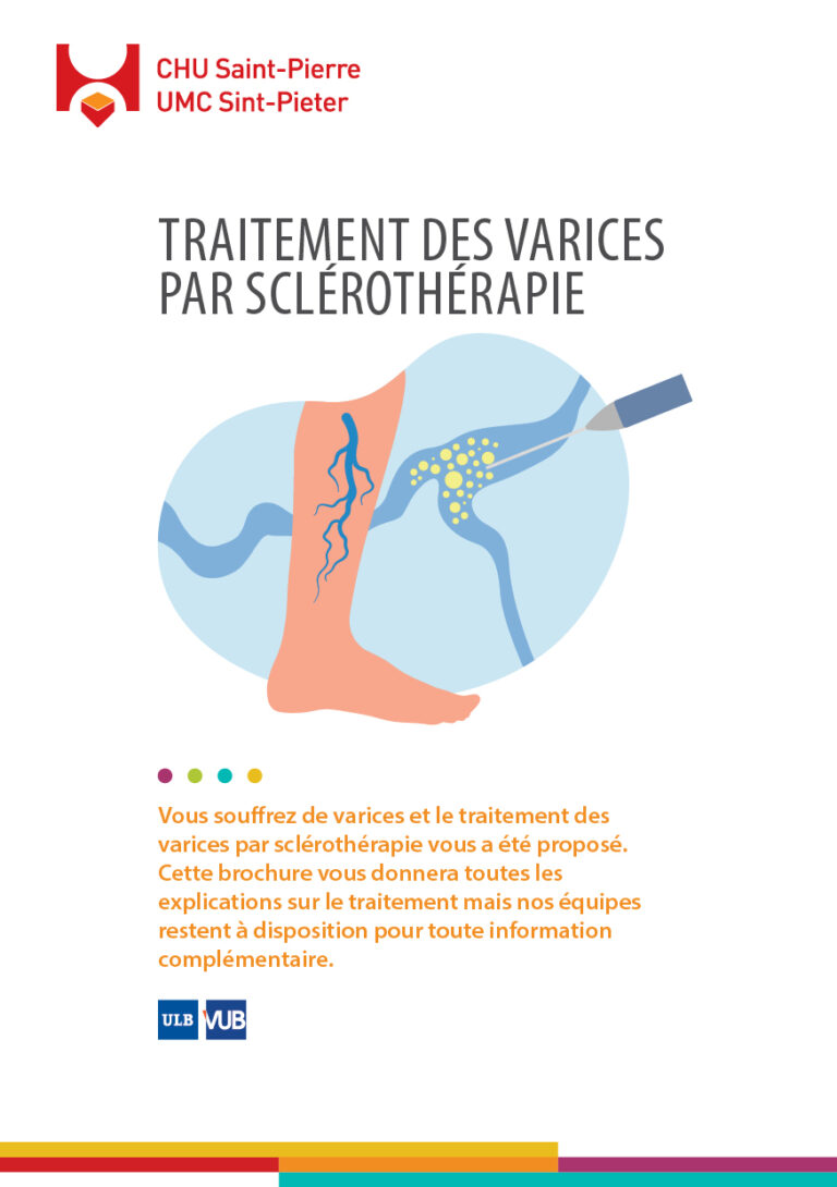 Varices Sclérothérapie