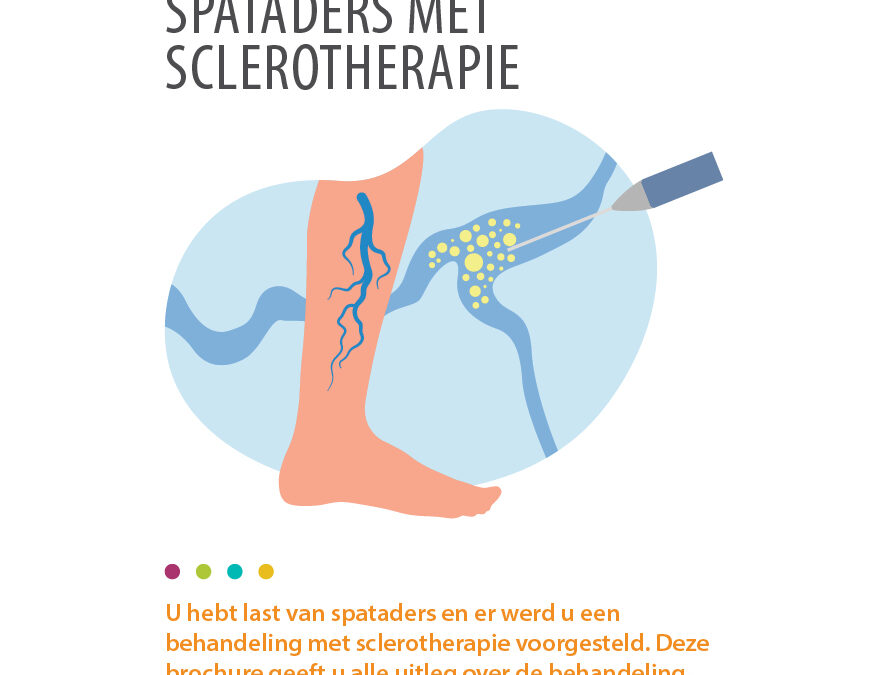 BEHANDELING VAN SPATADERS MET SCLEROTHERAPIE